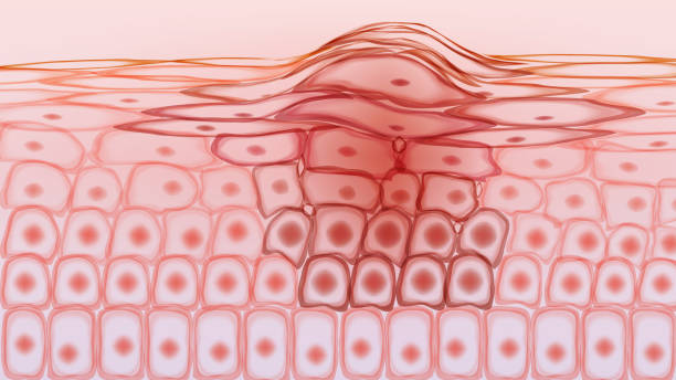 POPMEDICINE | Полное руководство по раку кожи: симптомы, диагностика и варианты лечения